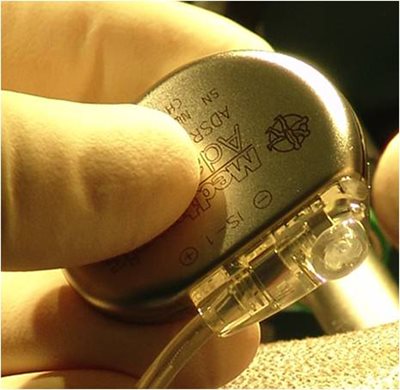 photo 5 : pulse generator