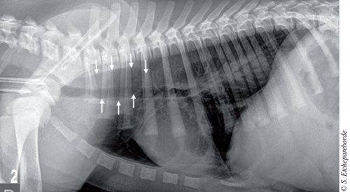 sténose aortique radiographie